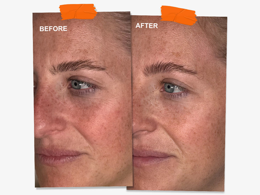 The Jaw-Dropping Overnight Results That Made Wrinkle Patches a Non-Negotiable