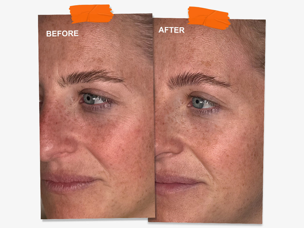 Wrinkles Schminkles blog banner on overnight wrinkle patch results in your 30s