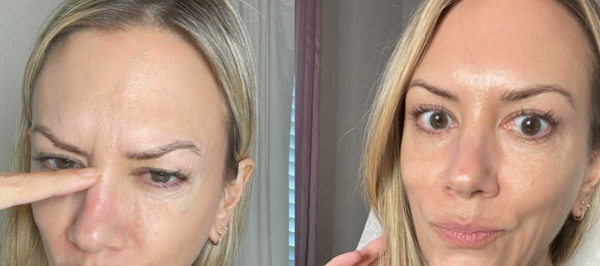Wrinkles Schminkles blog banner featuring a customer's overnight face taping results