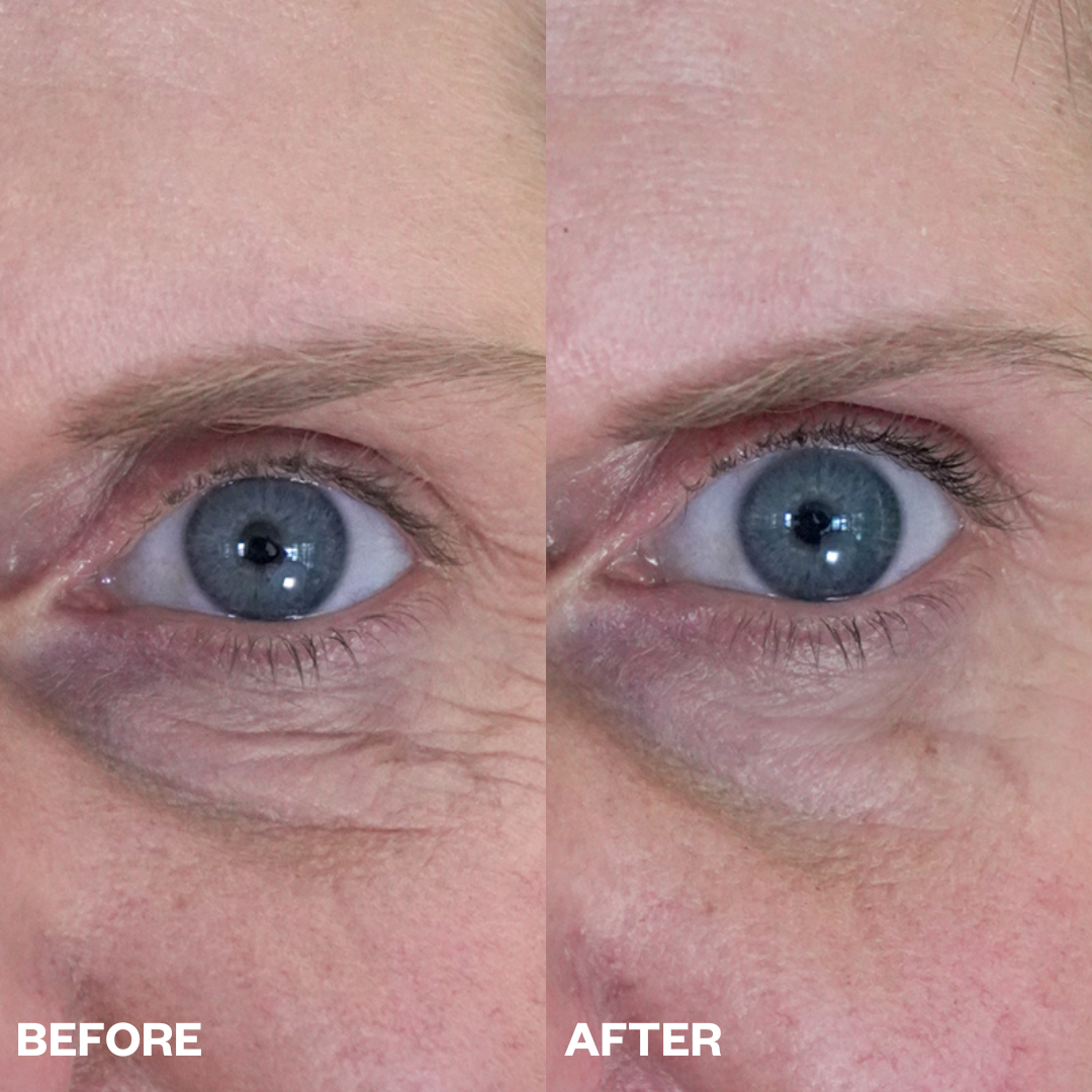 Wrinkles Schminkles blog banner, guide to smoothing under-eye bags and eye wrinkles