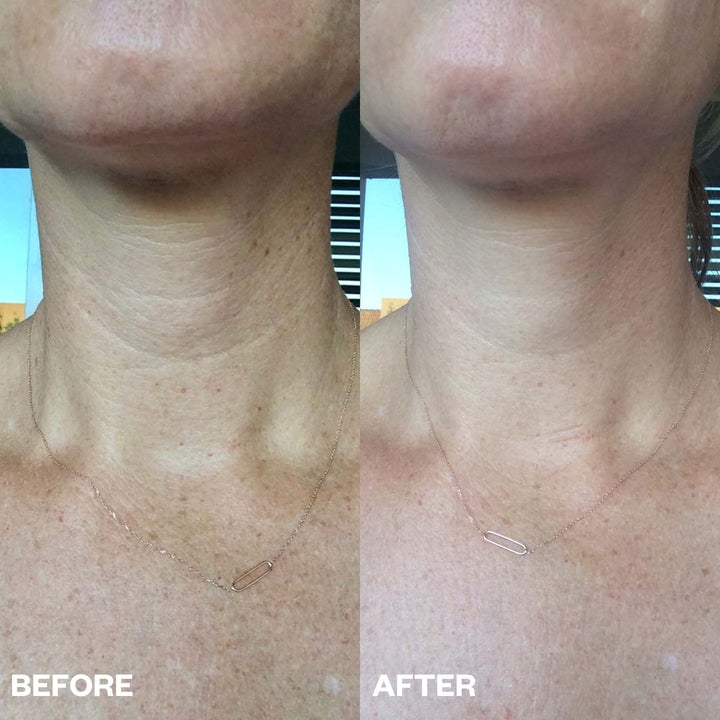 Skin Below the Chin Bundle
