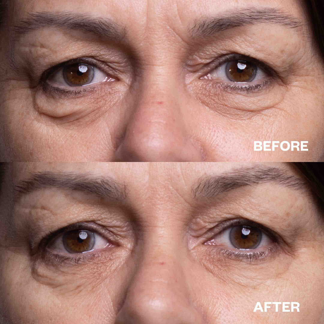 Total Eye Transformation Bundle
