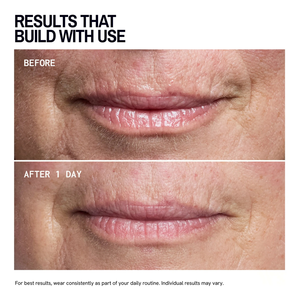 Mouth & Lip | Trial Patch
