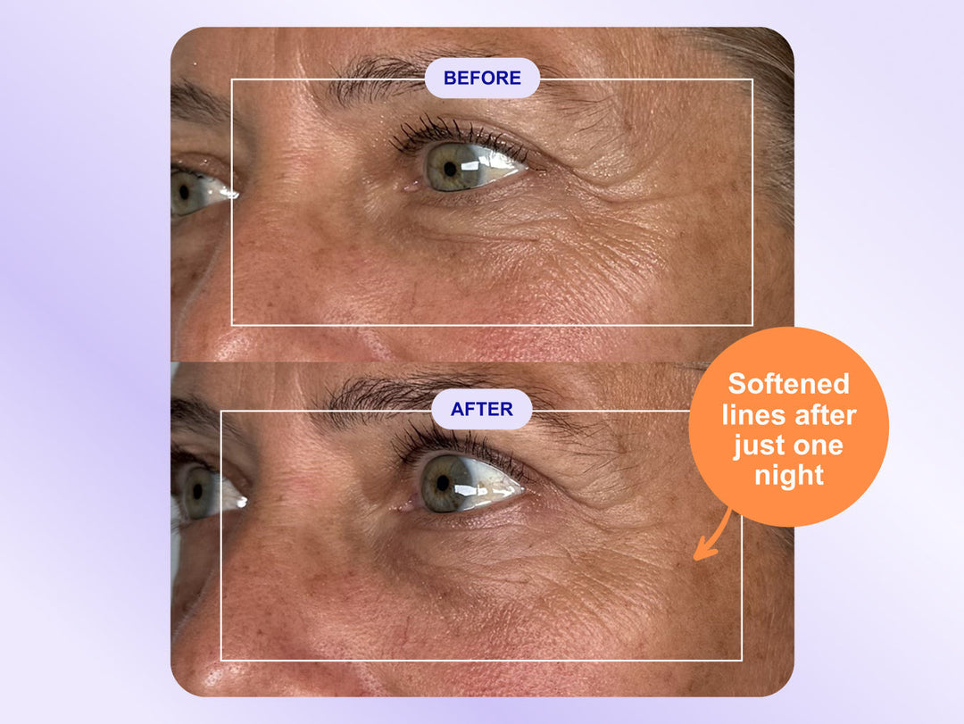 Wrinkles Schminkles blog banner for clinically tested overnight eye wrinkle patches