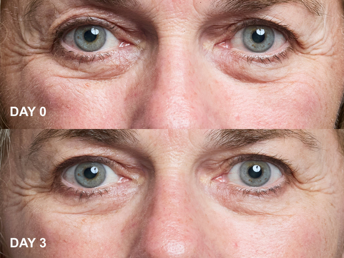 Wrinkles Schminkles blog banner on eye wrinkle patches