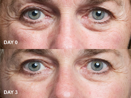Wrinkles Schminkles blog banner on eye wrinkle patches