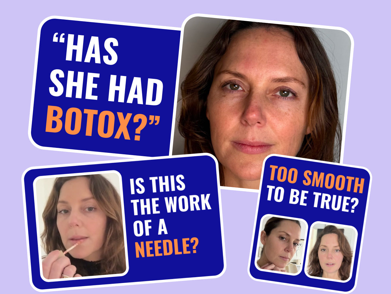 The Aesthetic Treatments Alternative That’ll Have People Asking Who Your Injector Is!