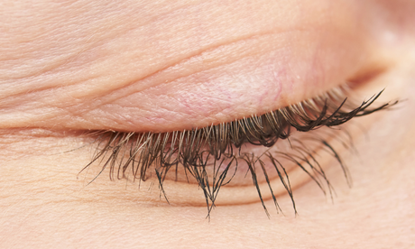 Wrinkles Schminkles blog banner comparing wrinkle treatment options
