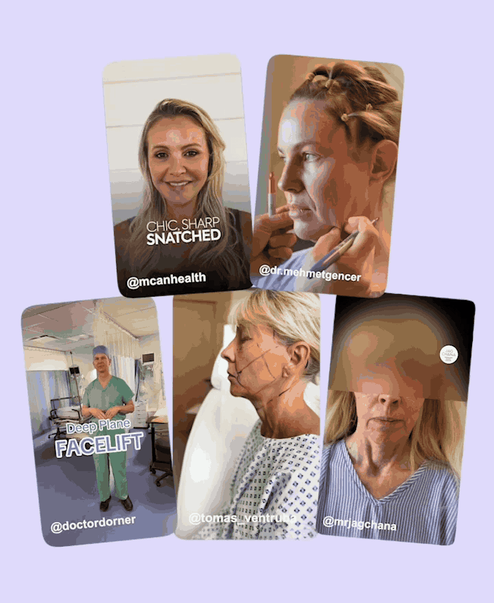 Non-Surgical Facelift: Dreaming Of An  Aesthetic Treatment? Try This Instead…