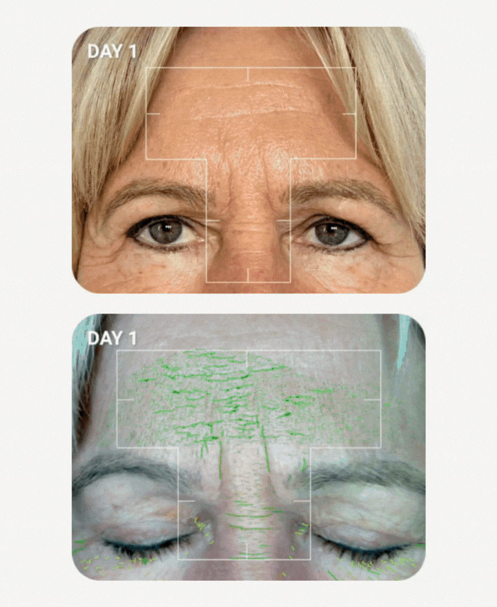 best skincare mature skin aesthetic treatments before after results