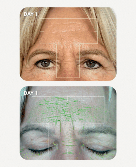 best skincare mature skin aesthetic treatments before after results