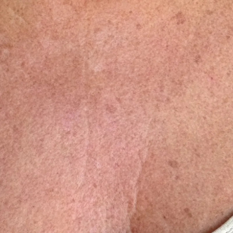 CHEST_AFTER_f14e9d5e-1ea9-4262-83e4-914c2fab773d.webp