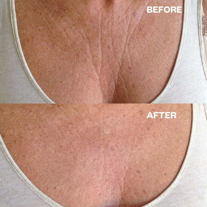 Décolletage Smoothing Duo