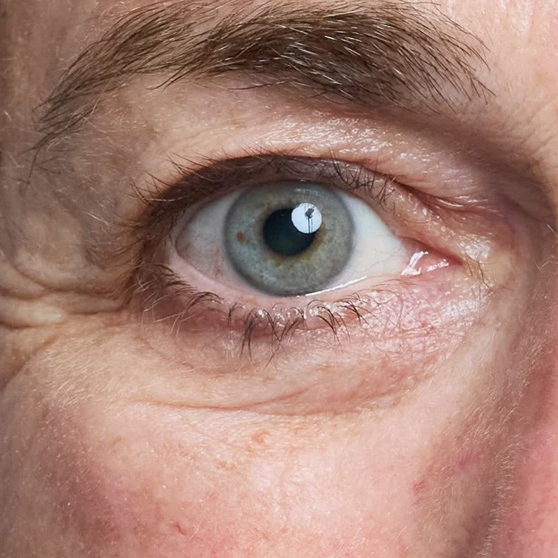 EYE_AFTER.webp