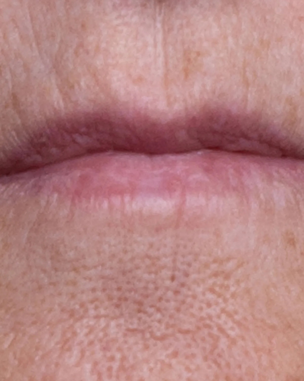 after-mouth-carousel-1.webp