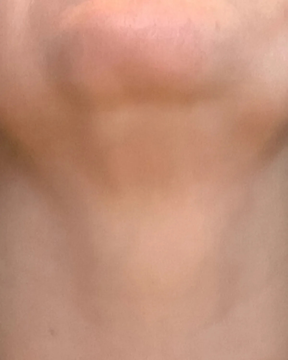 after-neck-carousel-1.webp