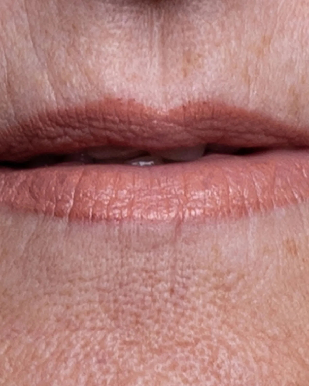 before-mouth-carousel-1.webp