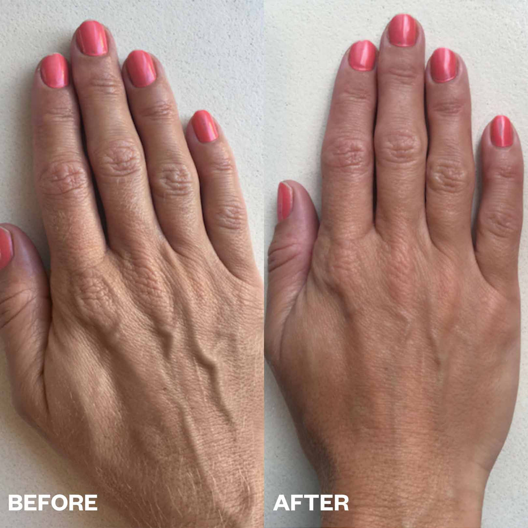 Skin Below the Chin Bundle