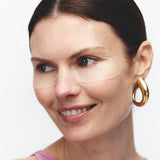 Eye patch applied to skin, a non-invasive alternative to aesthetic treatments for crow's feet and under-eye wrinkles
