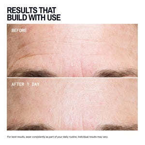 Forehead Wrinkles | Trial Patch