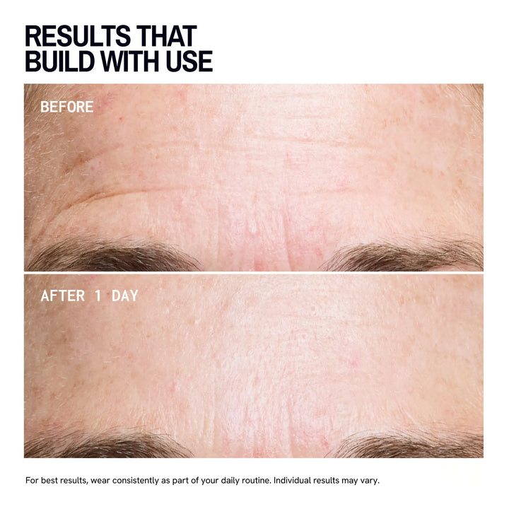 Forehead Wrinkle Patches