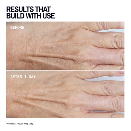 Hand Wrinkle Patches