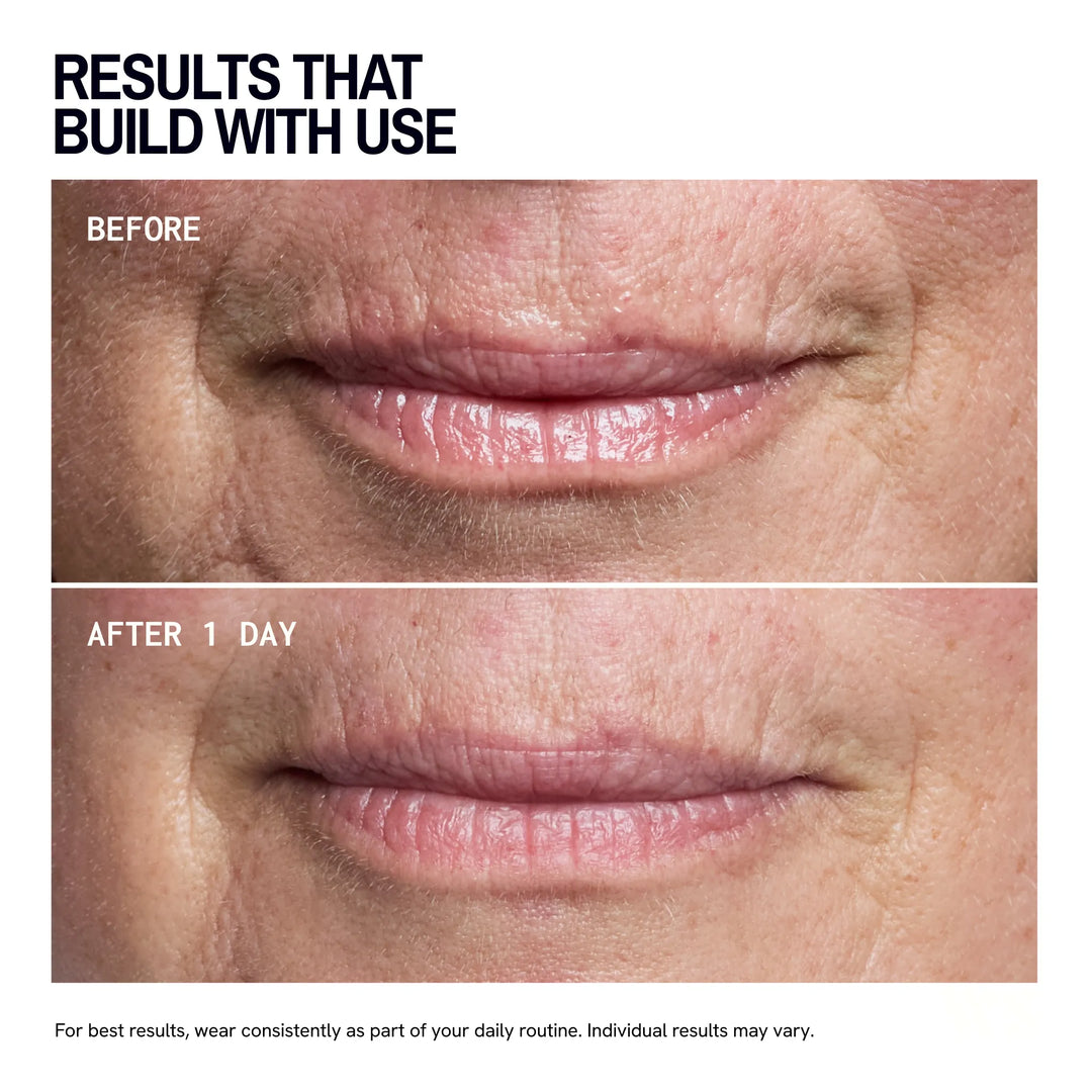 Mouth & Lip Wrinkle Patches