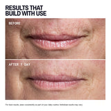 Mouth & Lip | Trial Patch