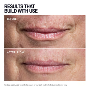Mouth & Lip | Trial Patch