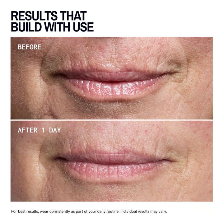 Mouth & Lip Wrinkle Patches